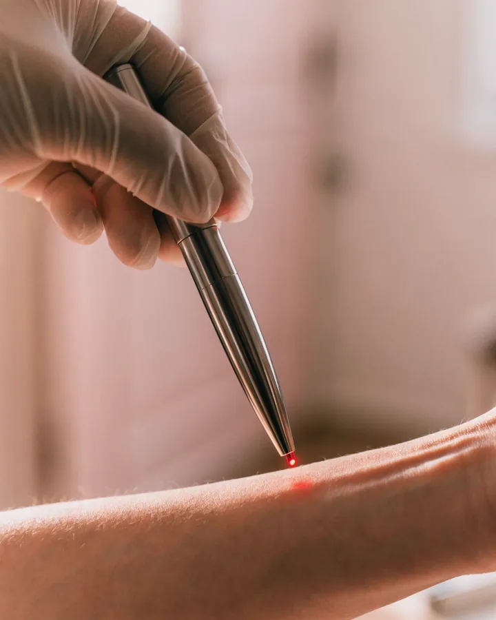 Caneta de laser de baixa intensidade próxima ao antebraço